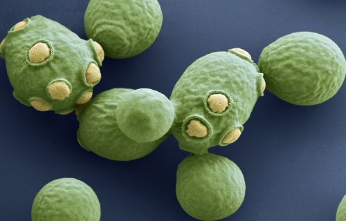 Batteri visti al microscopio