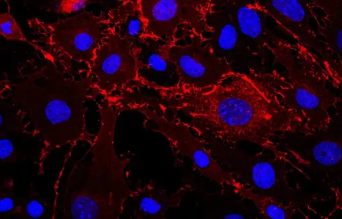 Cellule endoteliali